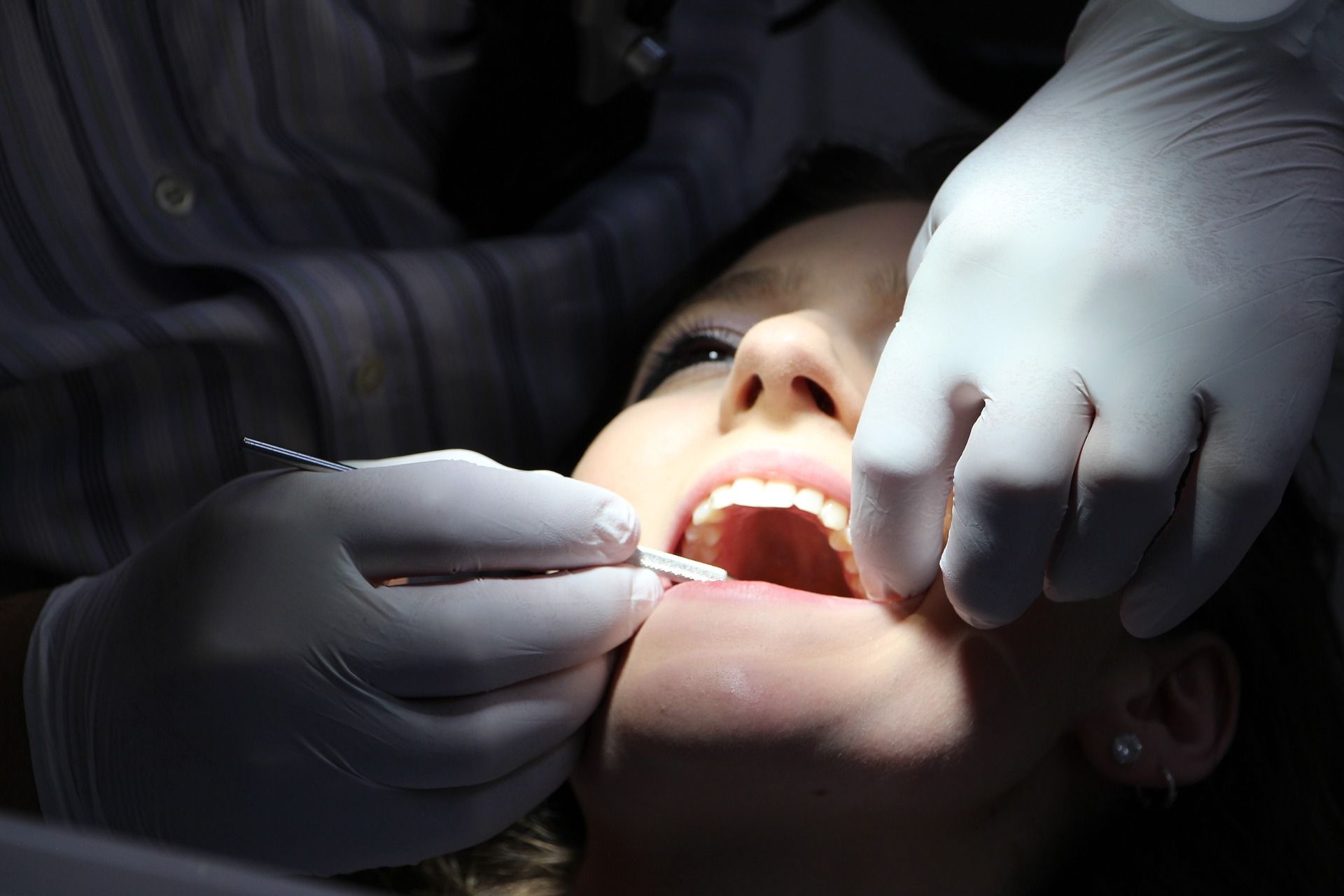 Si no se trata correctamente la gingivitis puede provocar periodontitis