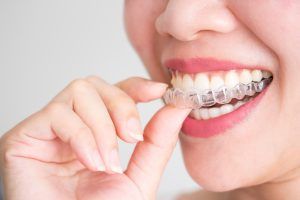 mujer utilizando ortodoncia invisible en vigo