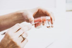 Gracias a la tecnología de última generación es posible reponer todos los dientes con implantes dentales y prótesis fijas en una única cita