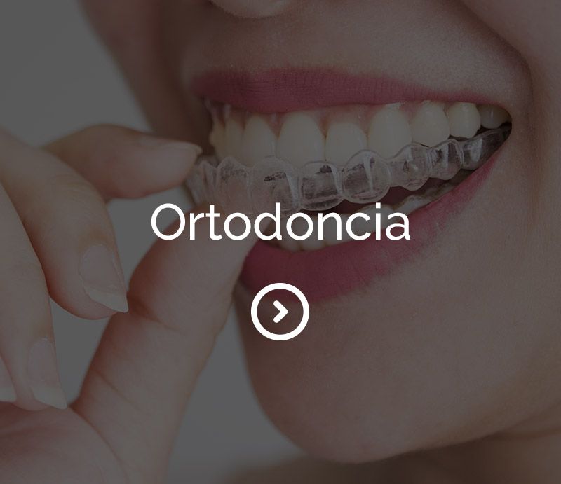 Ortodoncia Invisalign _hover
