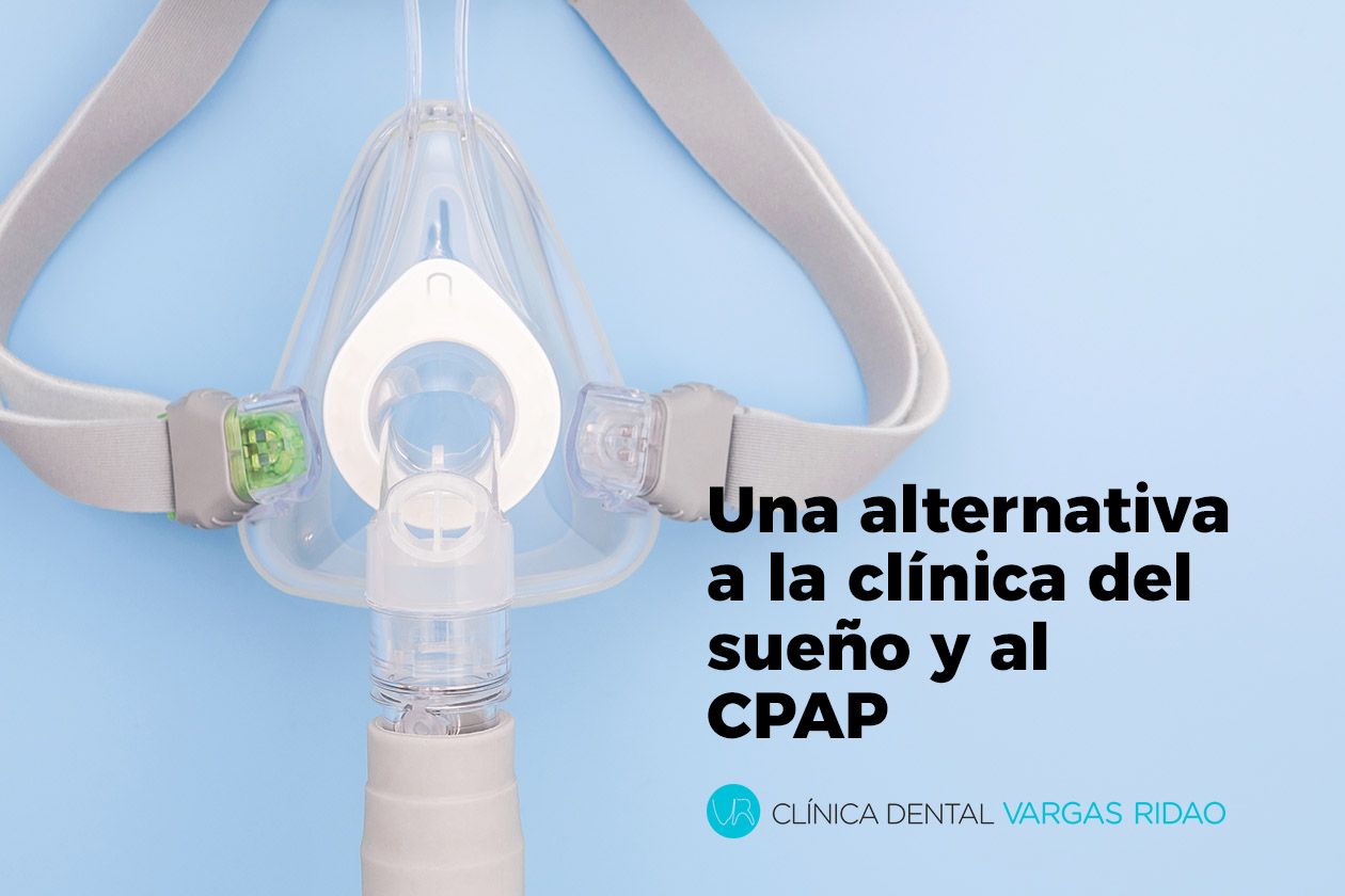 Las férulas de avance mandibular son una excelente alternativa al CPAP