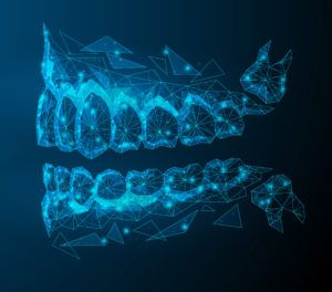 Regeneración ósea guiada, elevación sinusal - última tecnología en implantes dentales