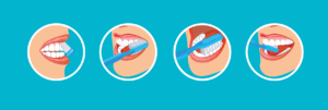 técnica de cepillado para prevenir enfermedades periodontales