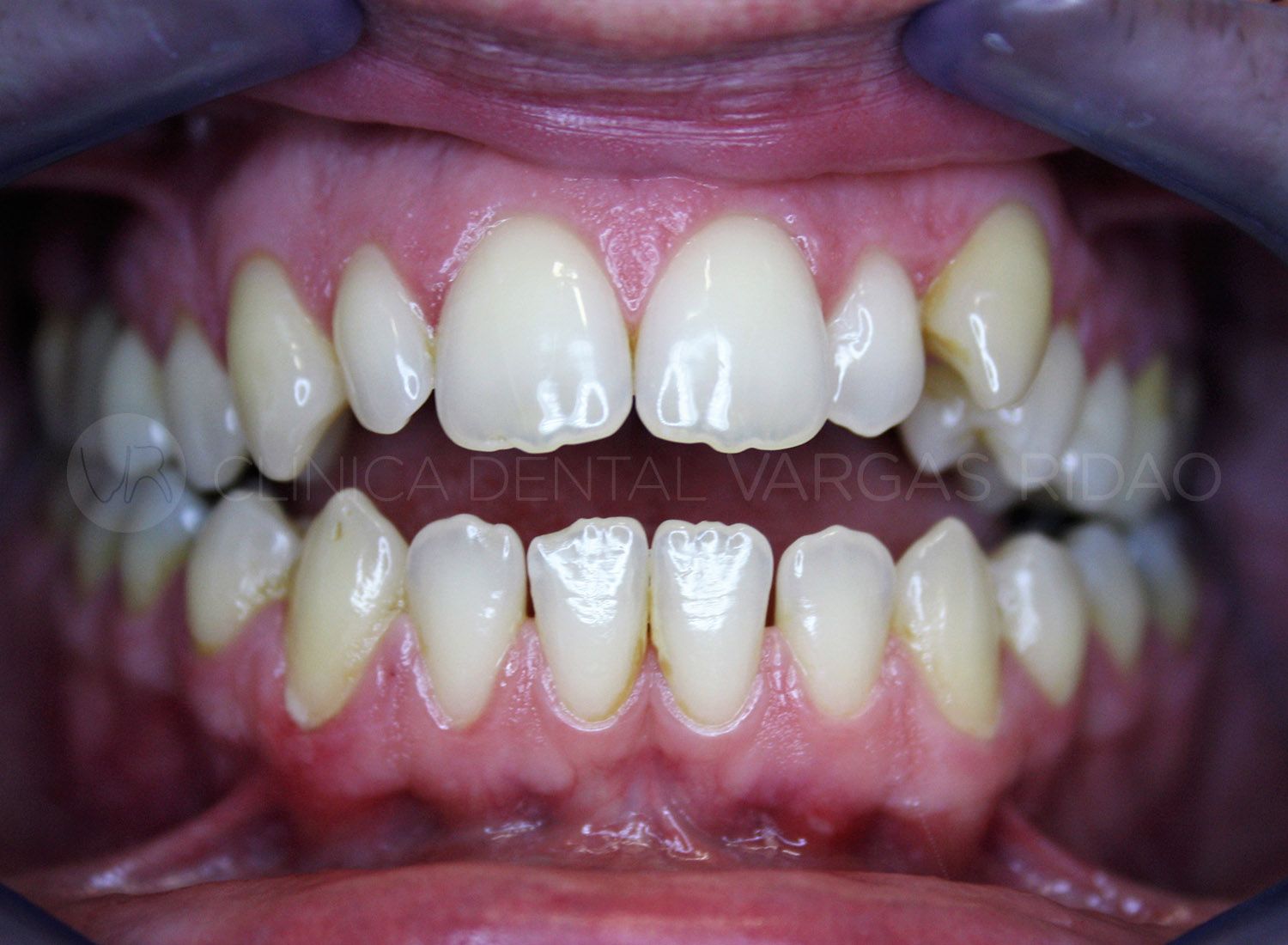 ortodoncia_1