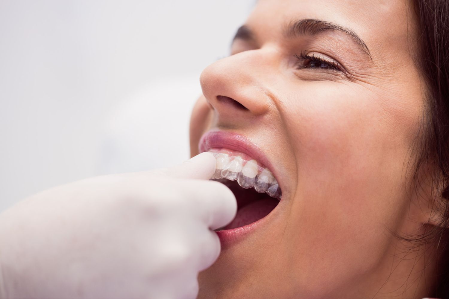 Un tratamiento de ortodoncia que solo alinee los dientes puede acarrear graves problemas de salud