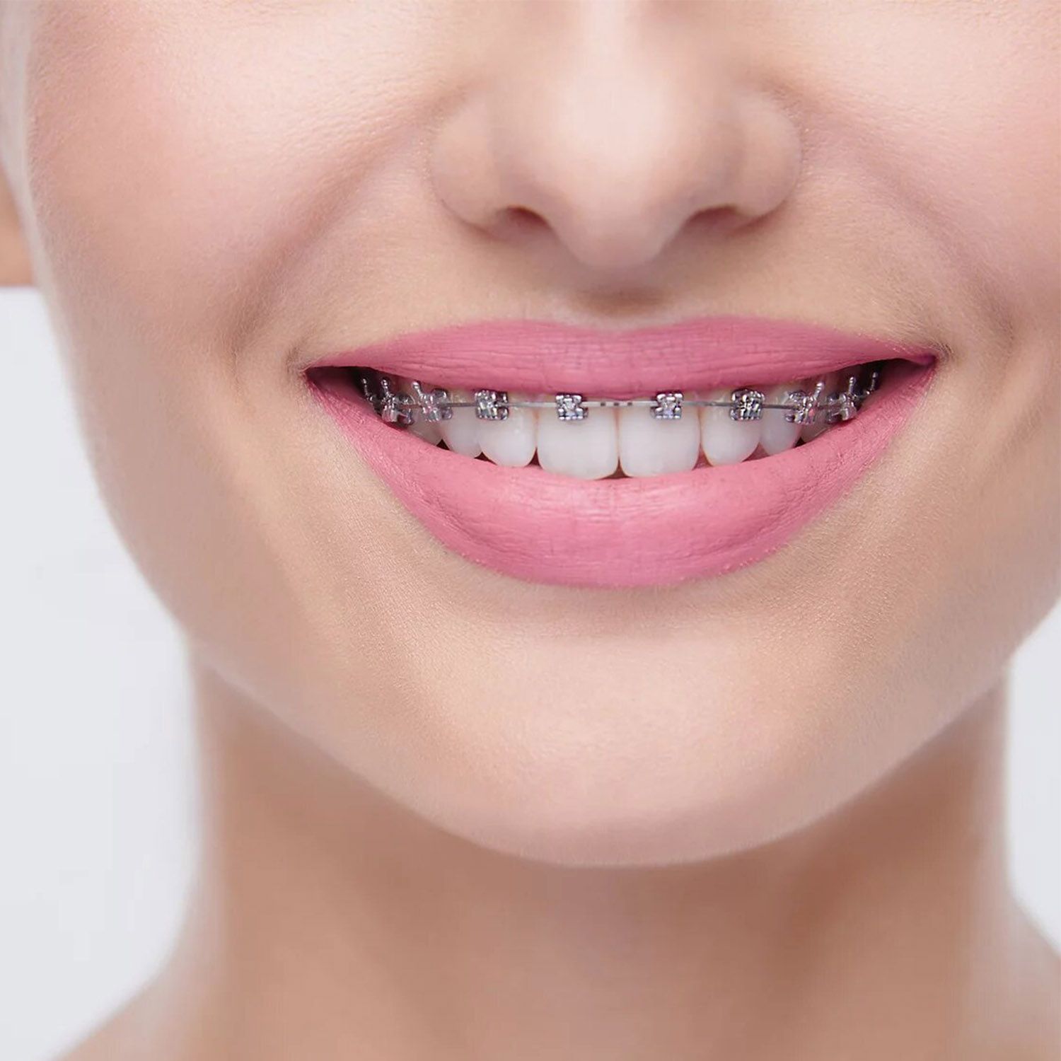Uno de los aspectos que debes saber sobre la ortodoncia es que es indoloro