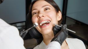 El stripping dental permite ampliar el espacio entre dientes