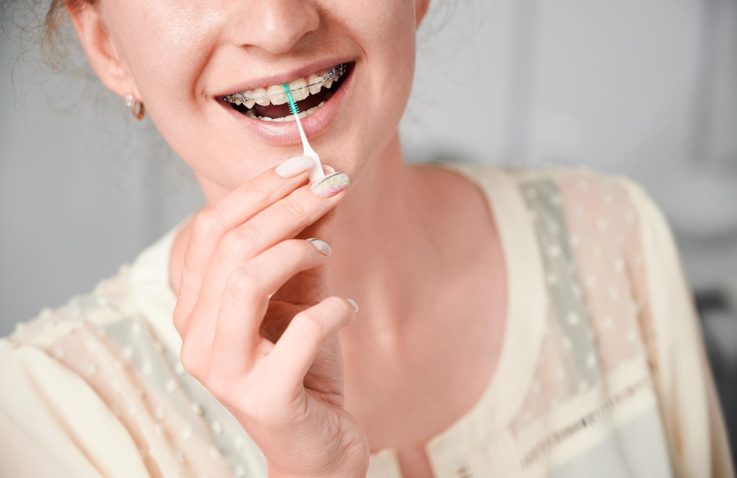 Cepillarse los dientes con brackets correctamente asegura una higiene oral óptima
