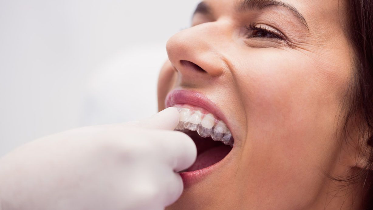 Un tratamiento de ortodoncia que solo alinee los dientes puede acarrear graves problemas de salud