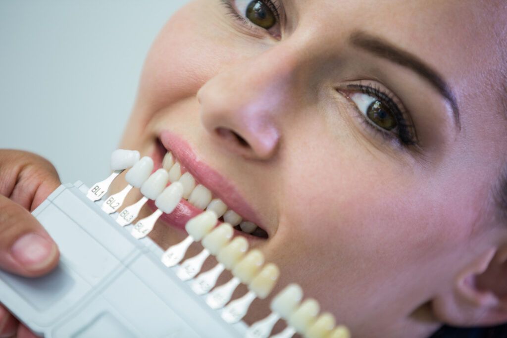 Las carillas dentales son tratamientos muy demandados en odontología estética